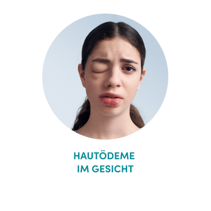 hautoedme-gesicht