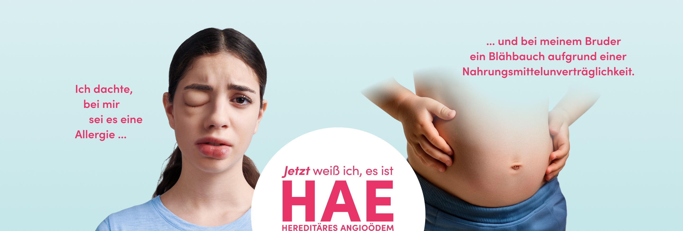Betroffene Patientin mit HAE-Symptomen (geschwollenes Auge) und Kind mit Blähbauch neben dem Claim: Jetzt weiß ich, es ist HAE.