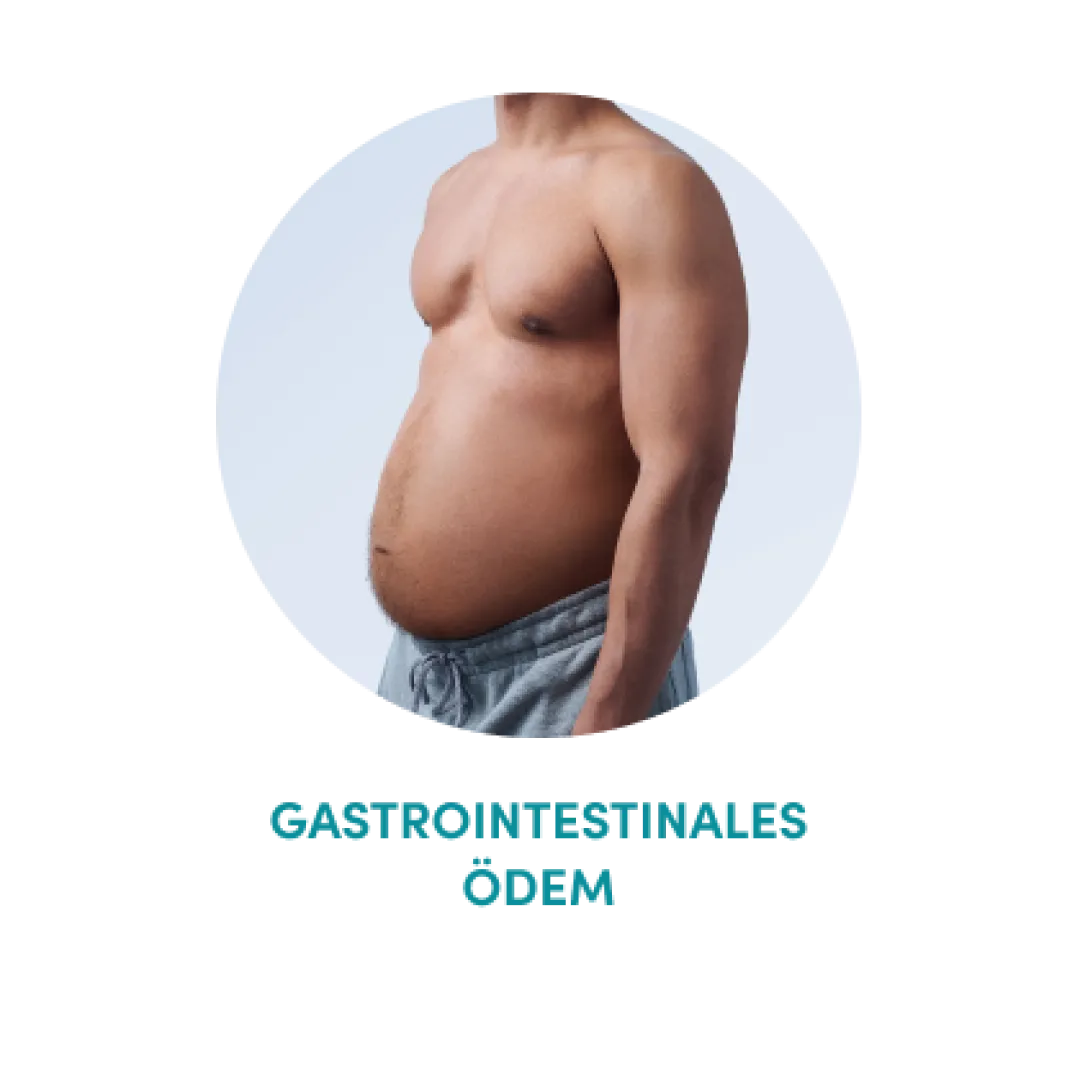 gastrointestinales-odem