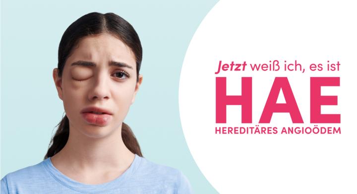 Betroffene Patientin mit HAE-Symptomen (geschwollenes Auge) und Kind mit Blähbauch neben dem Claim: Jetzt weiß ich, es ist HAE.